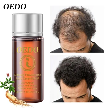 OEDO 2pcs/veliko las hitro rastočih bistvu za plešast eterično olje, zdravljenje, preprečevanje izpadanje las, učinkovito zdravljenje suhe lase