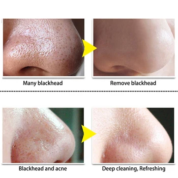 LANBENA Blackhead Odstranjevalec Nos Masko Por Trak Črno Peel Off Obrazno Masko za Akne Zdravljenje Black Globinsko Čiščenje Obraza za Nego Kože