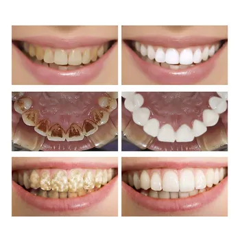 Beljenje Zob Je Bistvo V Prahu Ustno Higieno Čiščenje, Serum, Ki Odstrani Plaketo Madežev Beljenje Zob Zobna Orodja Zobno Pasto
