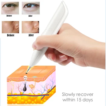 Laser Plazme Pero Odstraniti Pege Polnilna Spot Radirka Obraz Wart Spot Mol Tatoo Pika Odstranjevalec Kožo Obraza Čistejši Lepoti, Nego