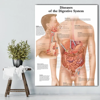 Prebavni Sistem, Slike Anatomski Karte In Plakate Anatomija Karte Bolezni Stenske Slike za Medicinsko Izobraževanje za Zdravnike